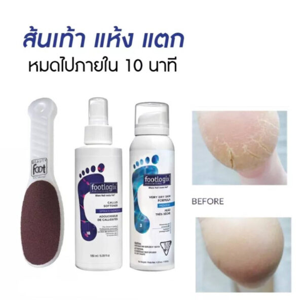 มินิเซต3ชิ้น Mousse#3Very Dry➕️ที่ขัดส้นเท้าญี่ปุ่นด้ามขาว➕Foot Callus 180ml.mini set Footlogixของแท้นำเข้าจากCANADA