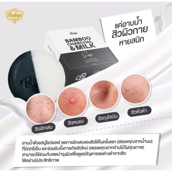 Rabye สบู่โชว์ออฟ ลดสิวผิวกาย ลดการอักเสบ​ ยับยั้งแบคทีเรีย​ ลดการเกิดสิวใหม่​ ผิวขาวใส ขนาด 100 กรัม (ส่งฟรี)​